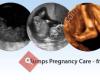 Bumps Pregnancy Care Centre