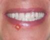 Cosmetic Denture Design, Teeth Whitening and Fangs by Speedy Denture Repairs LTD
