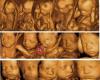 Early Pregnancy, Gender & 4D Baby Scans London, Watford - Window to the Womb